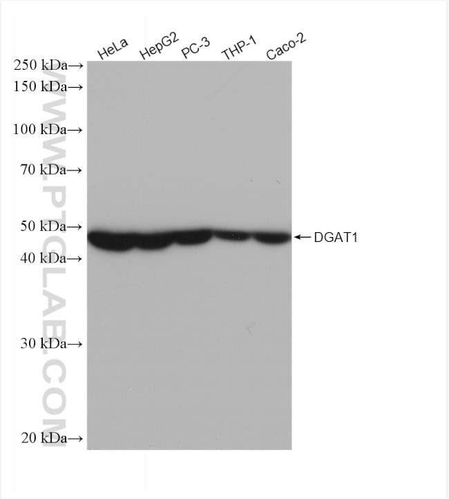 DGAT1 Antibody in Western Blot (WB)