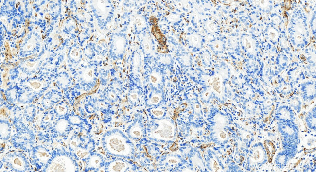 LAMB2 Antibody in Immunohistochemistry (Paraffin) (IHC (P))