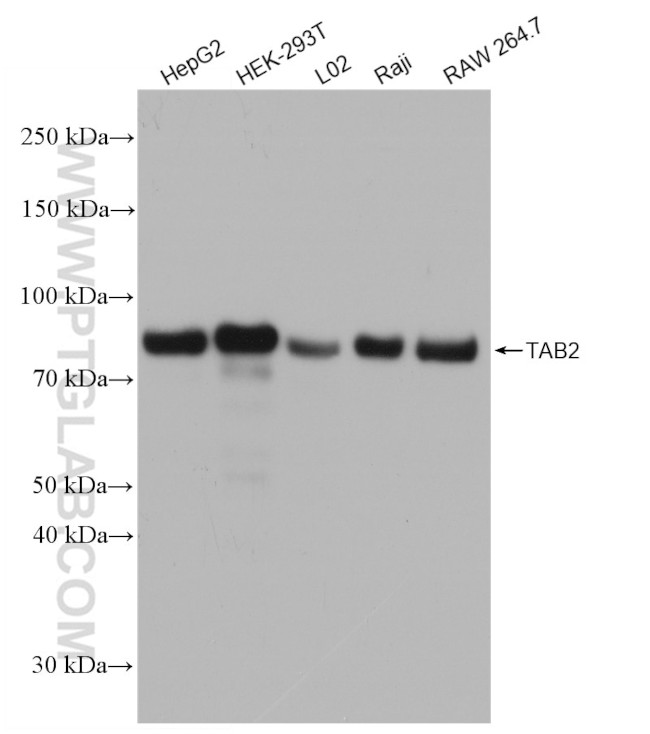 TAB2 Antibody in Western Blot (WB)