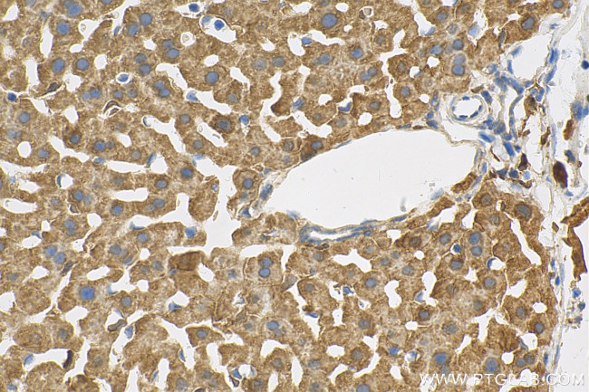 HEBP1 Antibody in Immunohistochemistry (Paraffin) (IHC (P))