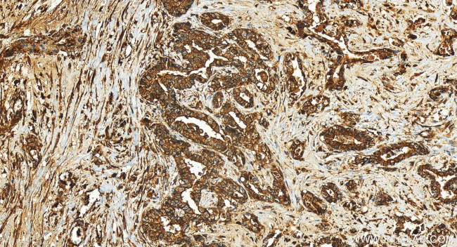 uPAR, PLAUR Antibody in Immunohistochemistry (Paraffin) (IHC (P))