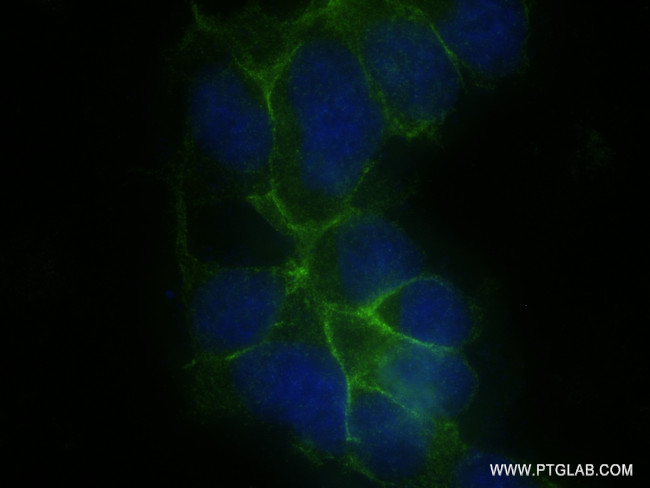 CLDN16 Antibody in Immunocytochemistry (ICC/IF)