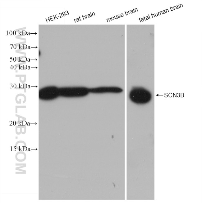 SCN3B Antibody in Western Blot (WB)