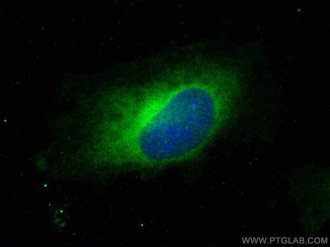 RAB32 Antibody in Immunocytochemistry (ICC/IF)