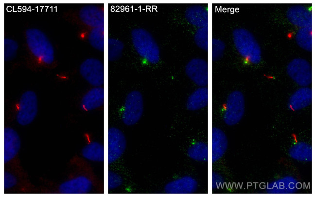 BBS4 Antibody in Immunocytochemistry (ICC/IF)