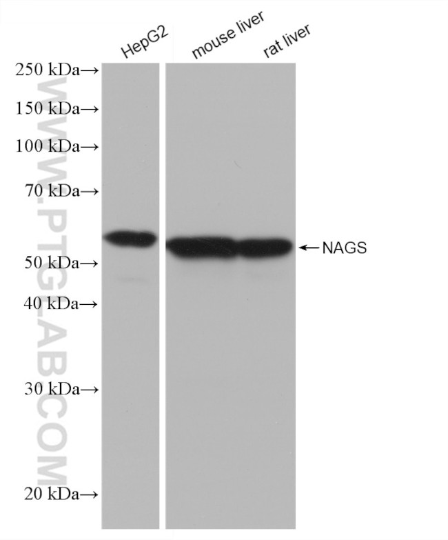 NAGS Antibody in Western Blot (WB)
