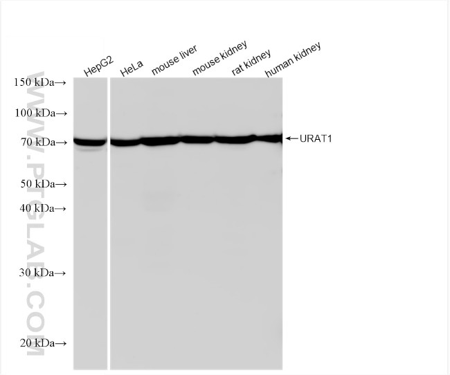 URAT1 Antibody in Western Blot (WB)