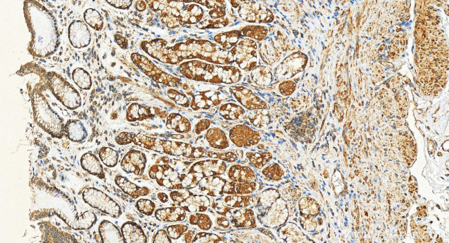 PGM5 Antibody in Immunohistochemistry (Paraffin) (IHC (P))