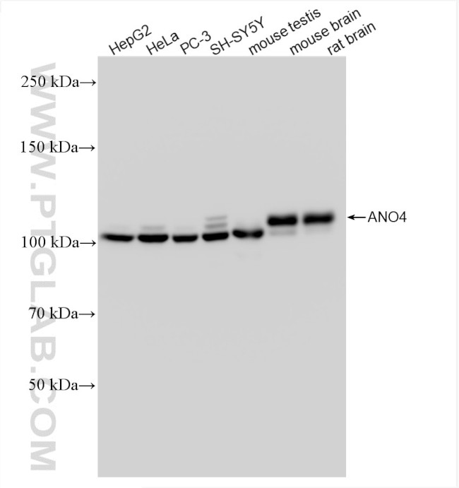 ANO4 Antibody in Western Blot (WB)