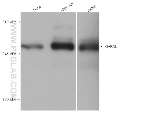 GARNL1 Antibody in Western Blot (WB)