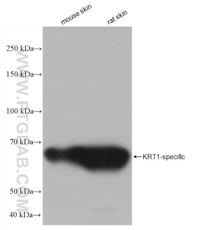 Cytokeratin 1 Antibody in Western Blot (WB)