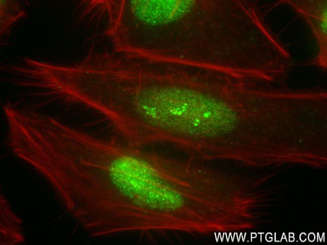 HMGB1 Antibody in Immunocytochemistry (ICC/IF)