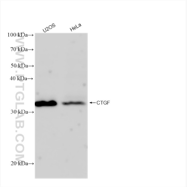 CTGF Antibody in Western Blot (WB)