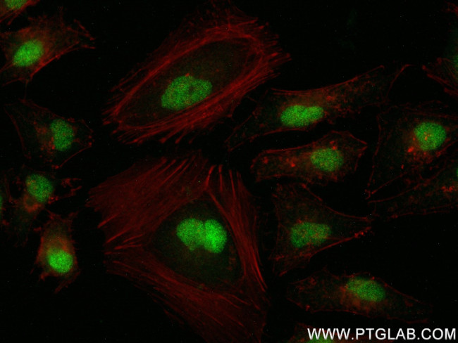 RAN Antibody in Immunocytochemistry (ICC/IF)