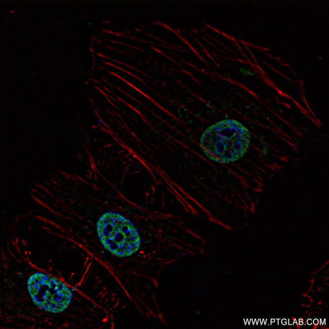 ARID1B Antibody in Immunocytochemistry (ICC/IF)