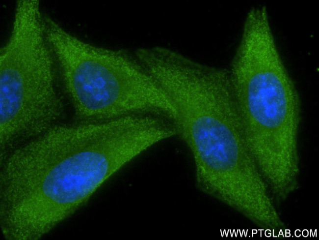 AFP Antibody in Immunocytochemistry (ICC/IF)
