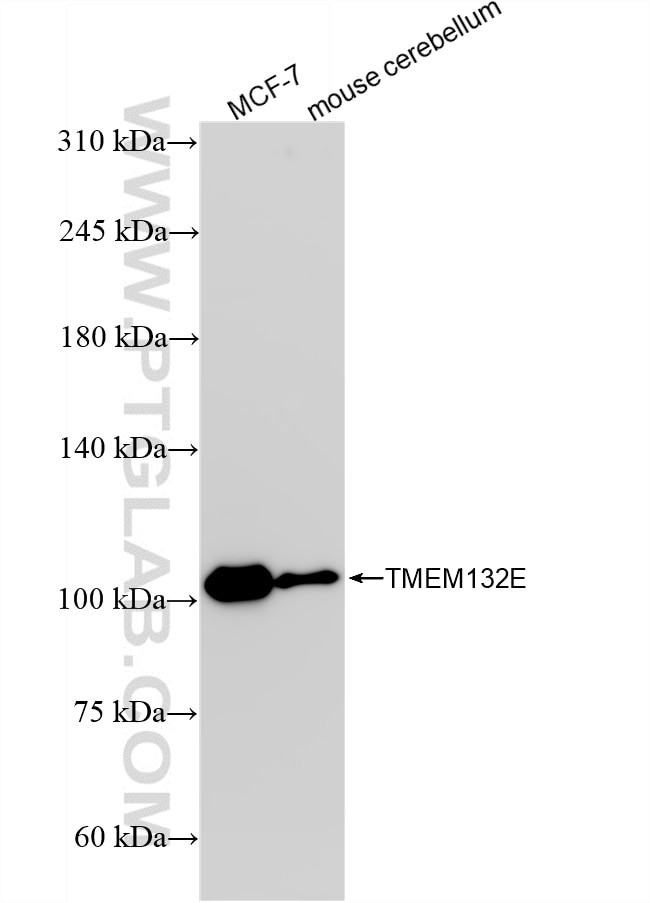 TMEM132E Antibody in Western Blot (WB)