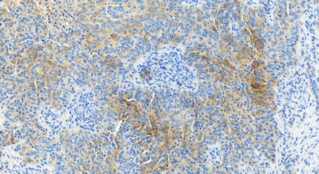 RILP Antibody in Immunohistochemistry (Paraffin) (IHC (P))