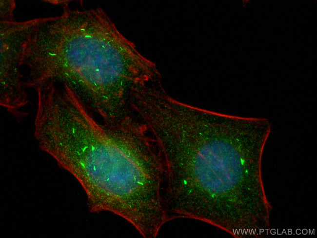 FOXO1 Antibody in Immunocytochemistry (ICC/IF)