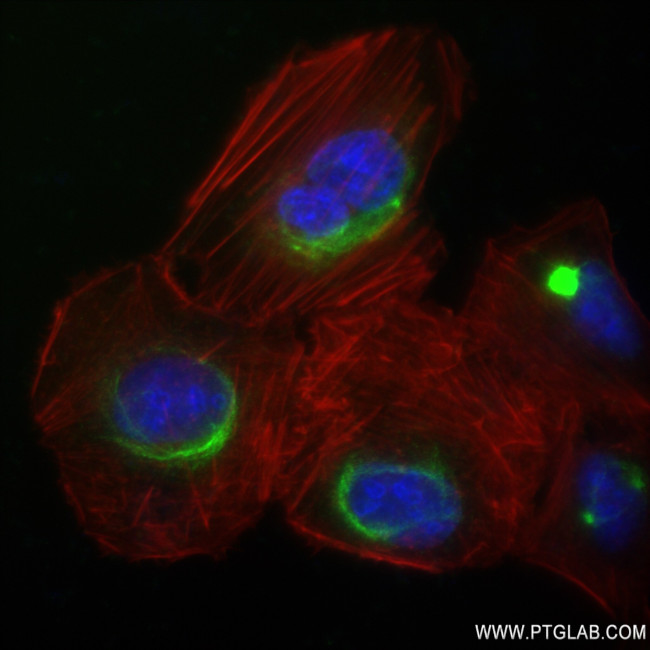 CCDC23 Antibody in Immunocytochemistry (ICC/IF)
