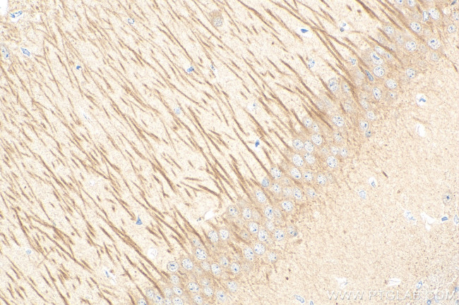 UNC13A Antibody in Immunohistochemistry (Paraffin) (IHC (P))