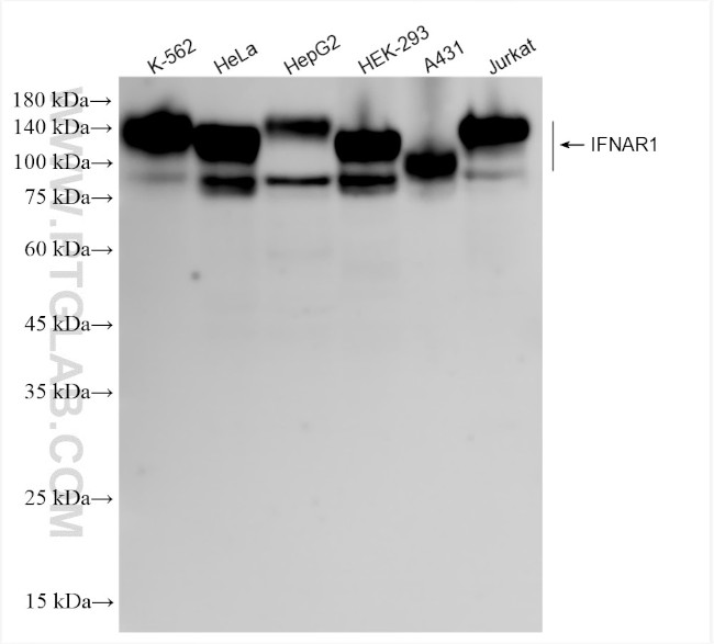 IFNAR1 Antibody in Western Blot (WB)