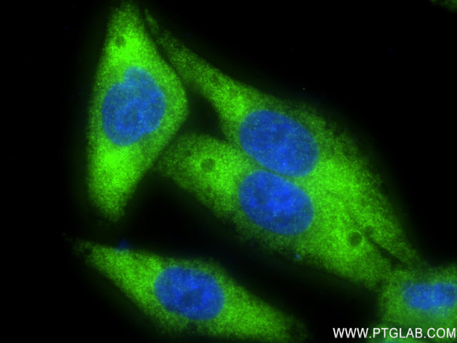 PCSK9 Antibody in Immunocytochemistry (ICC/IF)
