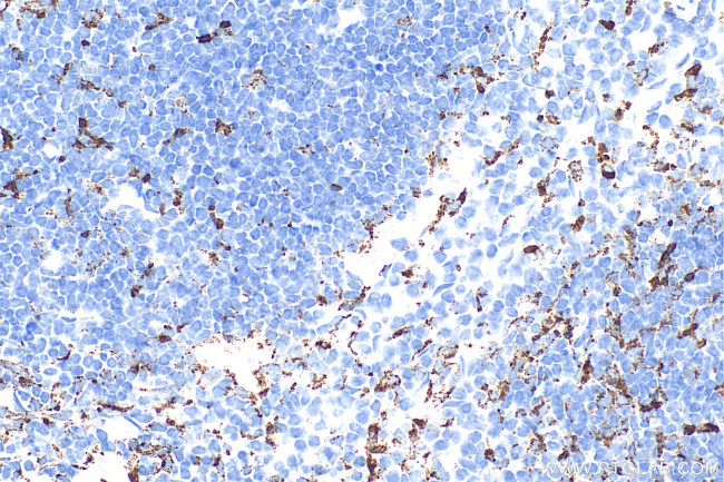 CD68 Antibody in Immunohistochemistry (Paraffin) (IHC (P))