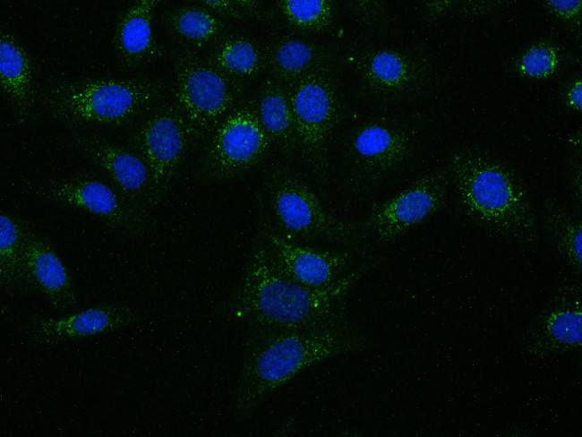 CTAGE5 Antibody in Immunocytochemistry (ICC/IF)