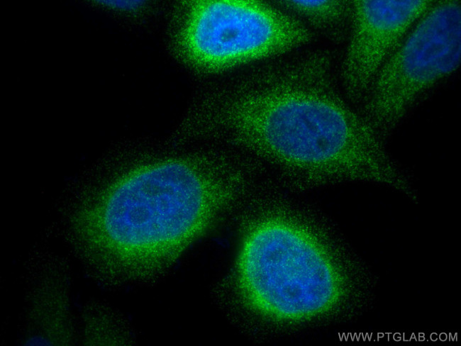FDFT1 Antibody in Immunocytochemistry (ICC/IF)