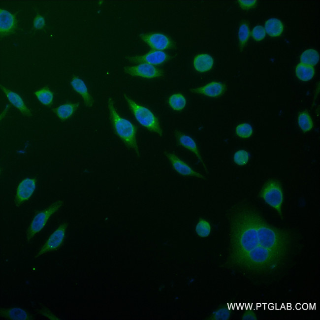 FDFT1 Antibody in Immunocytochemistry (ICC/IF)
