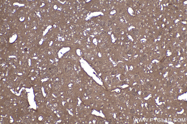 ACVR1B Antibody in Immunohistochemistry (Paraffin) (IHC (P))