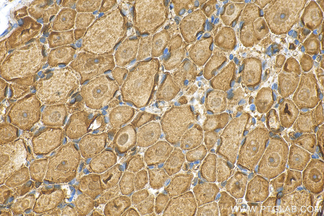 SCN4B Antibody in Immunohistochemistry (Paraffin) (IHC (P))