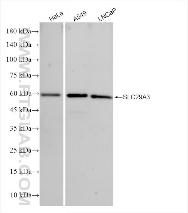 SLC29A3 Antibody in Western Blot (WB)
