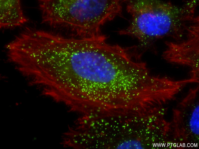 ABCD1 Antibody in Immunocytochemistry (ICC/IF)