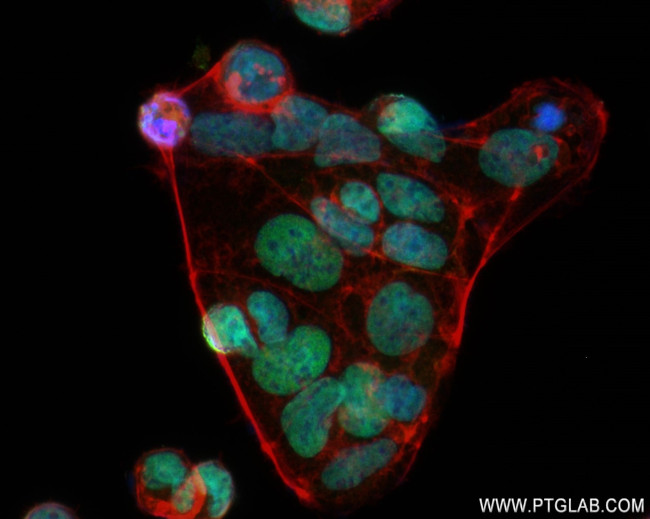 SALL4 Antibody in Immunocytochemistry (ICC/IF)