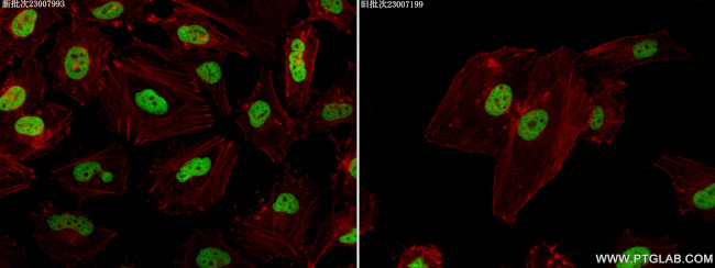 Acetyl-Histone H2A (Lys9) Antibody in Immunocytochemistry (ICC/IF)