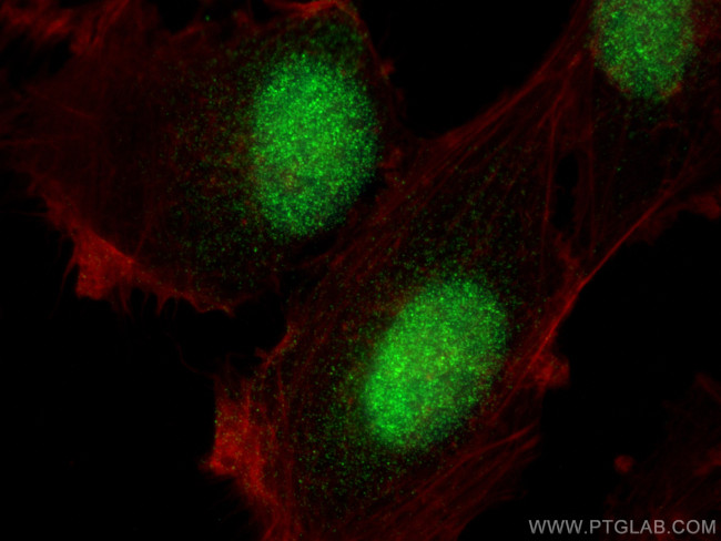 MTA3 Antibody in Immunocytochemistry (ICC/IF)
