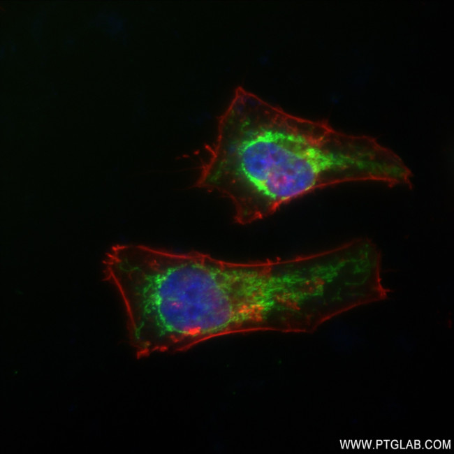 SURF1 Antibody in Immunocytochemistry (ICC/IF)