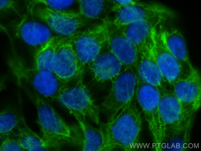 Cytokeratin 13 Antibody in Immunocytochemistry (ICC/IF)