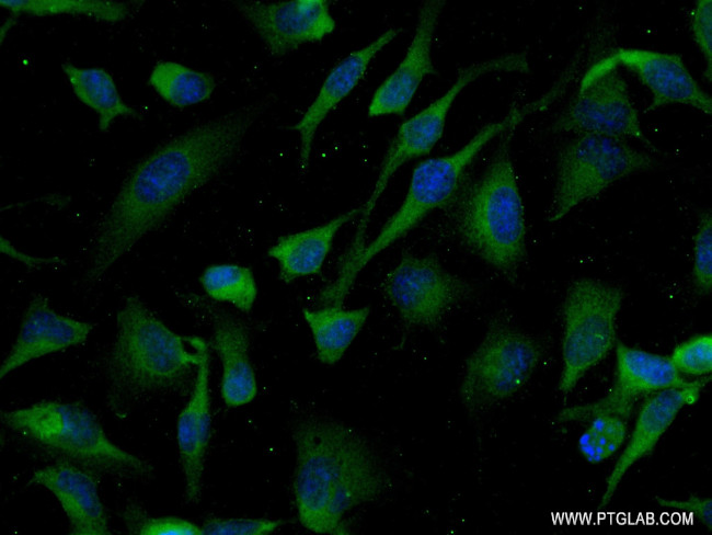 Tnfrsf11b Antibody in Immunocytochemistry (ICC/IF)