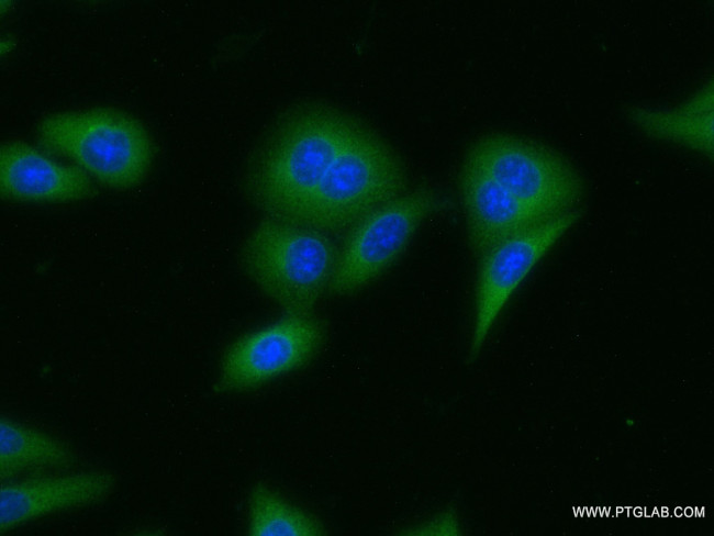 LCMT2 Antibody in Immunocytochemistry (ICC/IF)