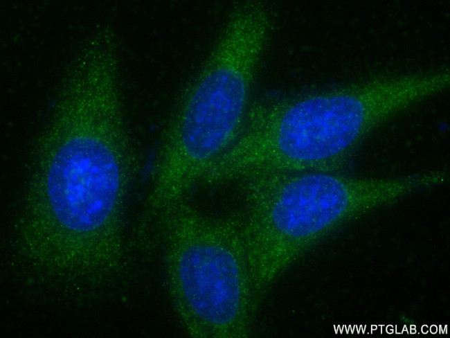PFAS Antibody in Immunocytochemistry (ICC/IF)