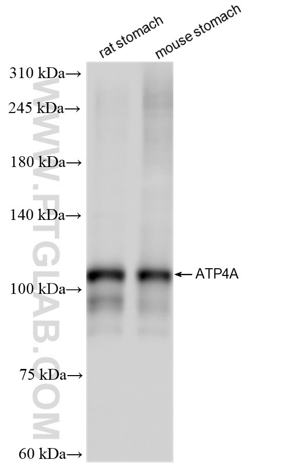 ATP4A Antibody in Western Blot (WB)