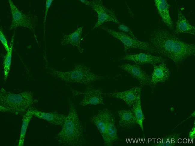 STK39 Antibody in Immunocytochemistry (ICC/IF)