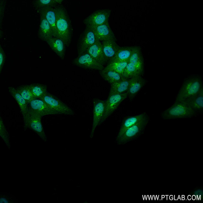 STK39 Antibody in Immunocytochemistry (ICC/IF)