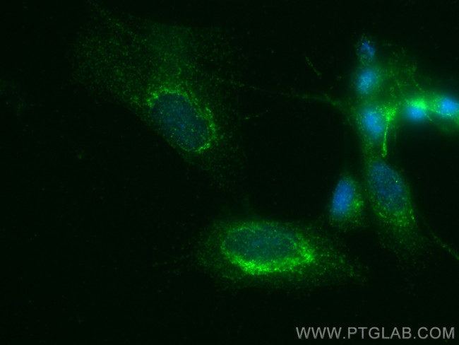 GDNF Antibody in Immunocytochemistry (ICC/IF)