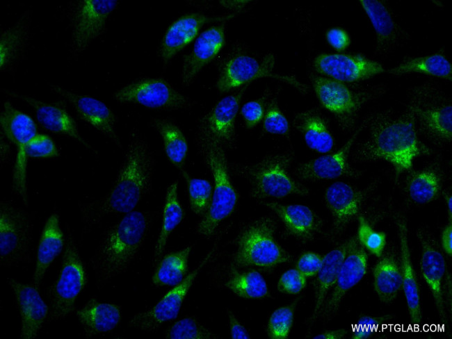 COPA Antibody in Immunocytochemistry (ICC/IF)