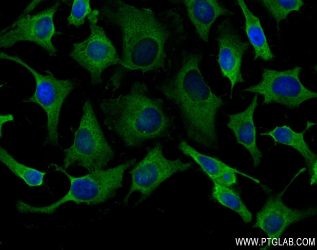 COPA Antibody in Immunocytochemistry (ICC/IF)