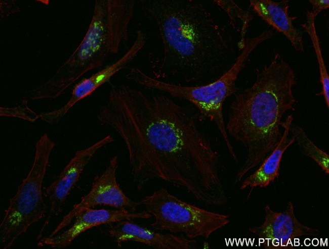 TGOLN2, TGN46 Antibody in Immunocytochemistry (ICC/IF)